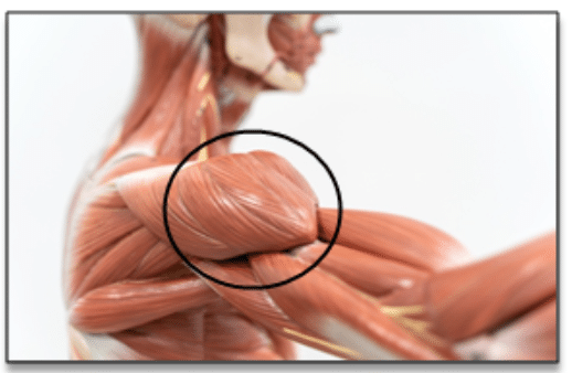 Lateral Side Shoulder Pain