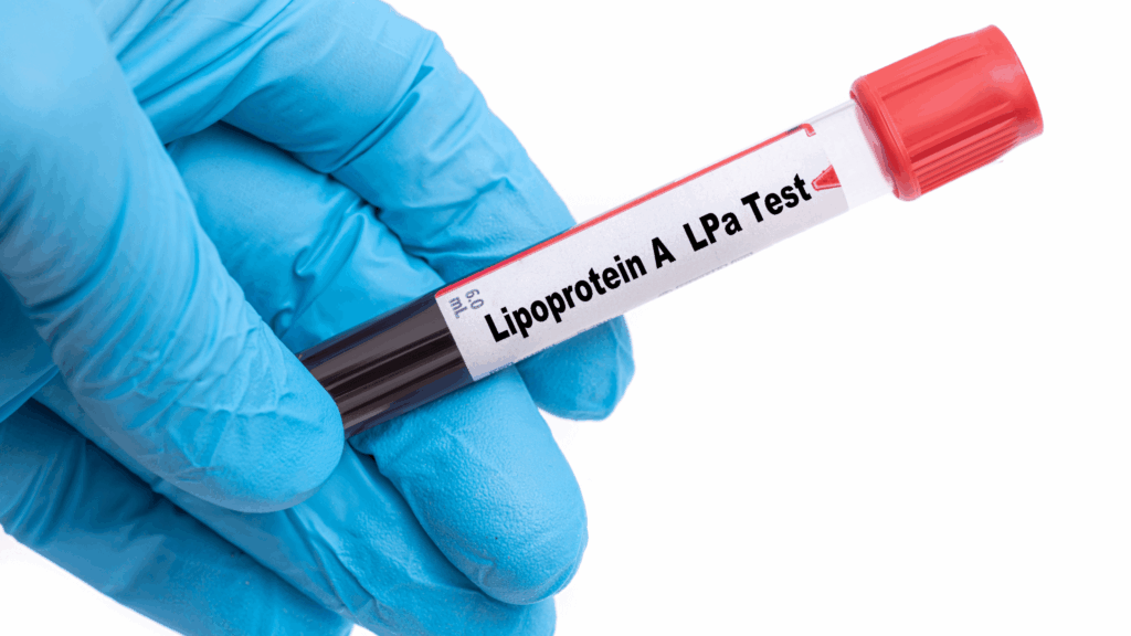 Lipoprotein Test