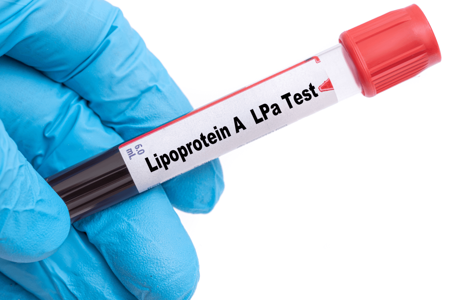 Lipoprotein featured image