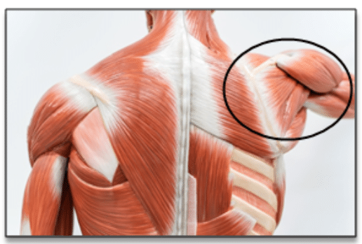 Posterior Back Shoulder Pain
