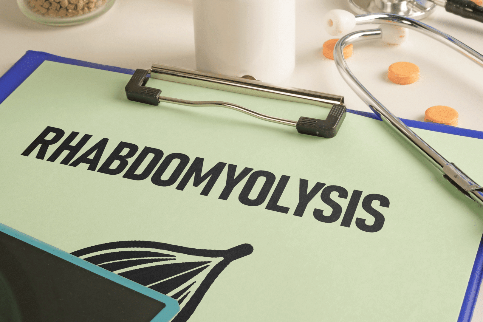 Rhabdo featured image